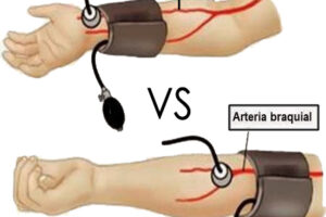 Tensiómetro de brazo o tensiómetro de muñeca ¿Cuál es mejor?